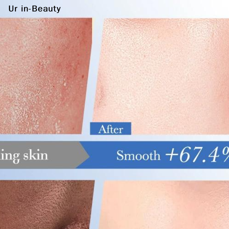 Ceramide Moisturizer - BIOAOUA Ceramide Hyaluronic Acid Moisturizing Cream