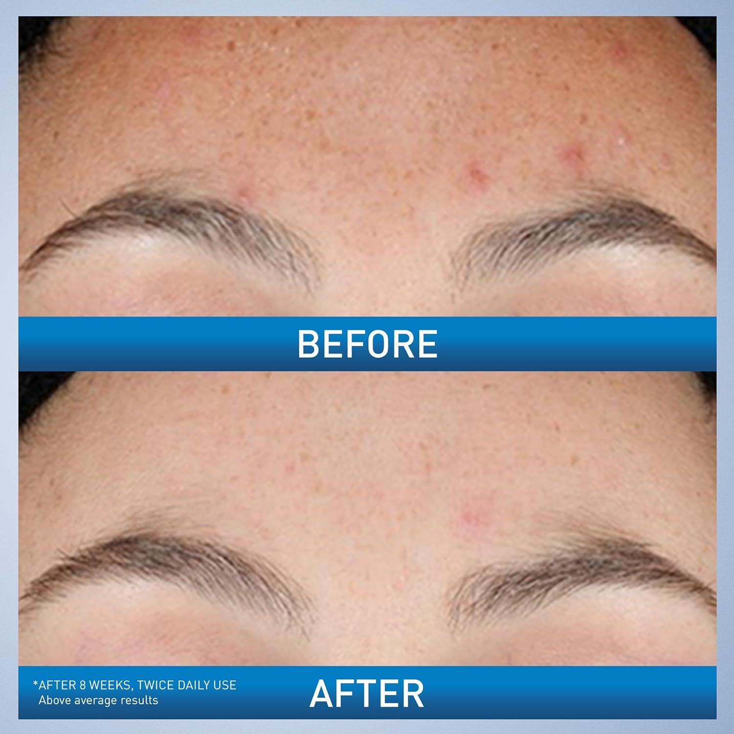 CeraVe Retinol Serum Niacinami - đánh giá và giá Skincare Non Comedogenic